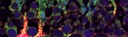 Bunch of Peroxisome Flower_Immunofluorescence-Acrosome cross-reactivity of antibodies_Wenwen Wang.jpg