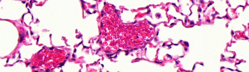 In the earth of the lung_H&E staining of section from mouse lung_Sylwia Skwarna.jpg